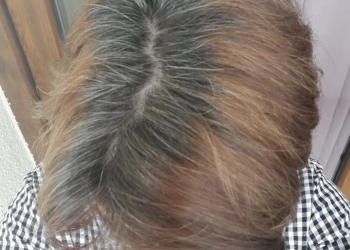 inainte-de-henna-mandala-par-natural-vopsit-cu-fire-albe
