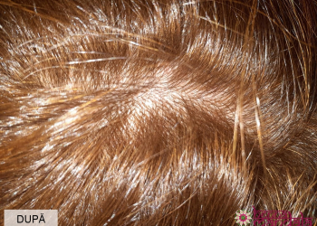 Dupa-Henna-Mandala-Blond-actionare-35-min-radacini-min