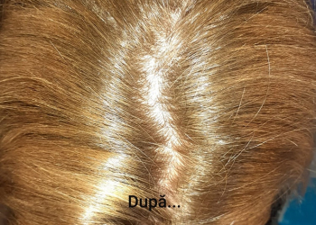 Radacini-vopsite-cu-Henna-Mandala-Blond